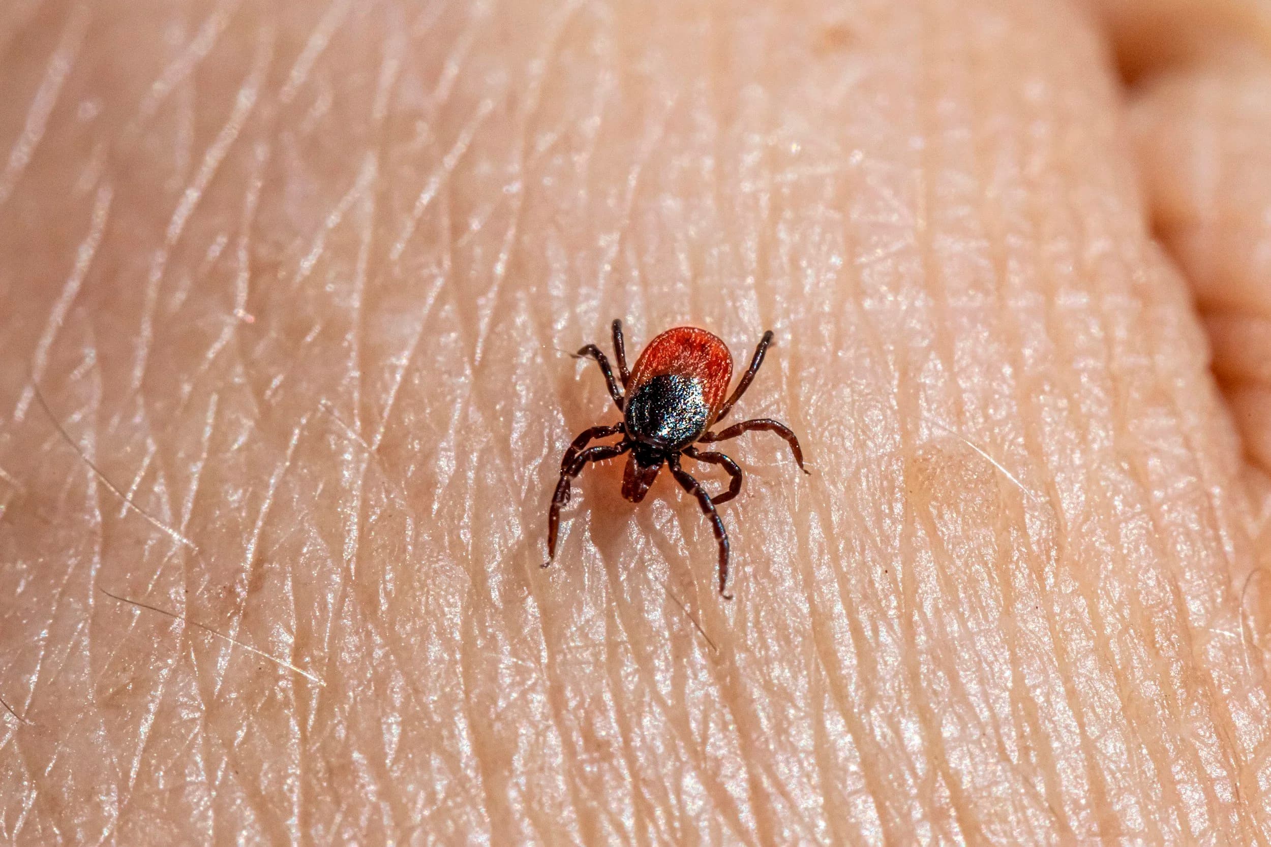 La Maladie de Lyme et les Piqûres de Tiques : Ce que Vous Devez Savoir au Québec